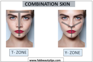  T zone, Y zone, Combination Skin, Skin Types