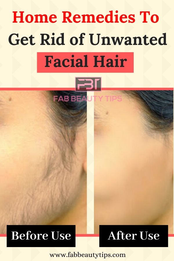 facial hair removal, facial hair removal at home, get rid of unwanted facial hair, home remedies to get rid of unwanted facial hair, unwanted facial hair