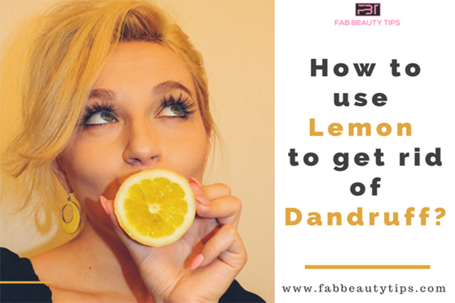 How to use lemon to get rid of dandruff, lemon for dandruff, lemon to get rid of dandruff
