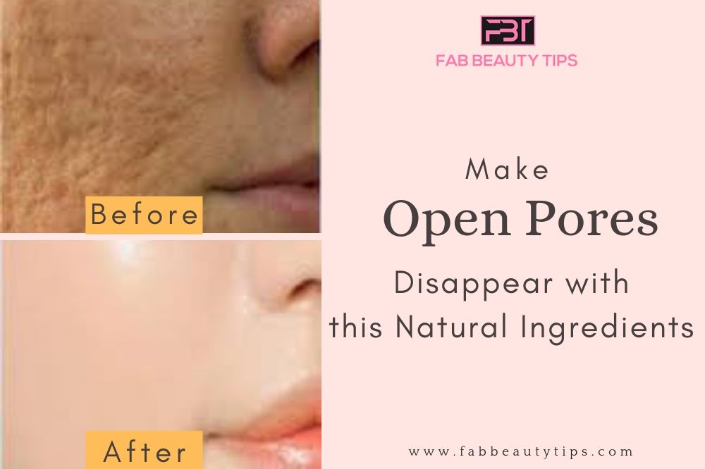 home remedies for large pores, home remedies for open pores, how to remove pores from face, How to remove open pores from face