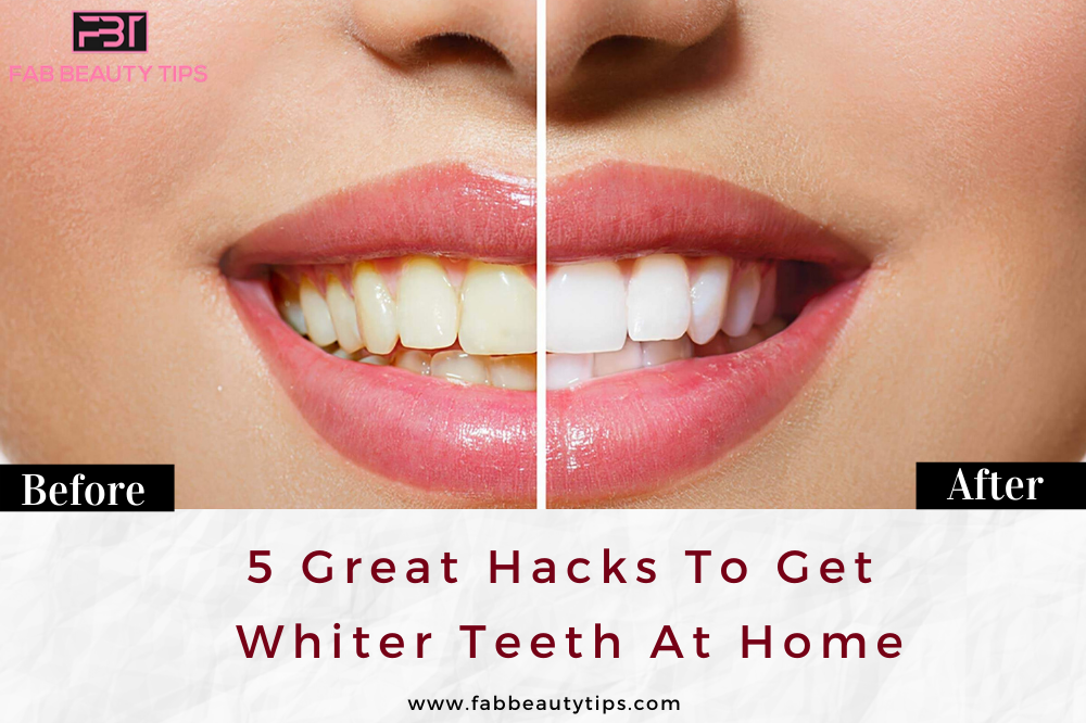 get whiter teeth, get whiter teeth at home, Hacks to get whiter teeth