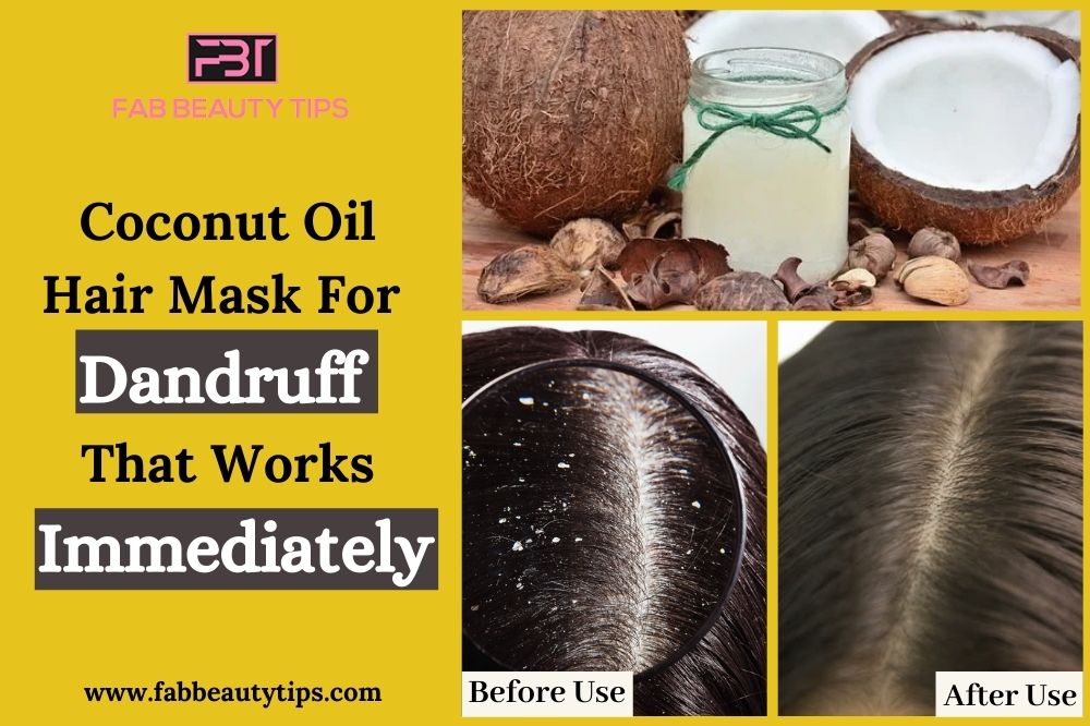 Coconut Oil Dandruff, Coconut Oil Dandruff Hair Masks, Coconut Oil for Dandruff