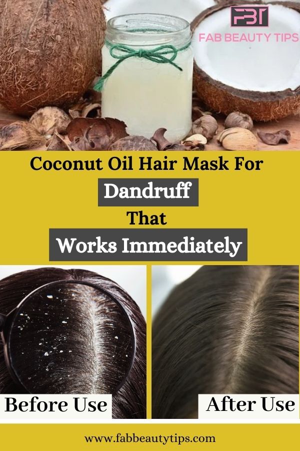 Coconut Oil Dandruff, Coconut Oil Dandruff Hair Masks, Coconut Oil for Dandruff