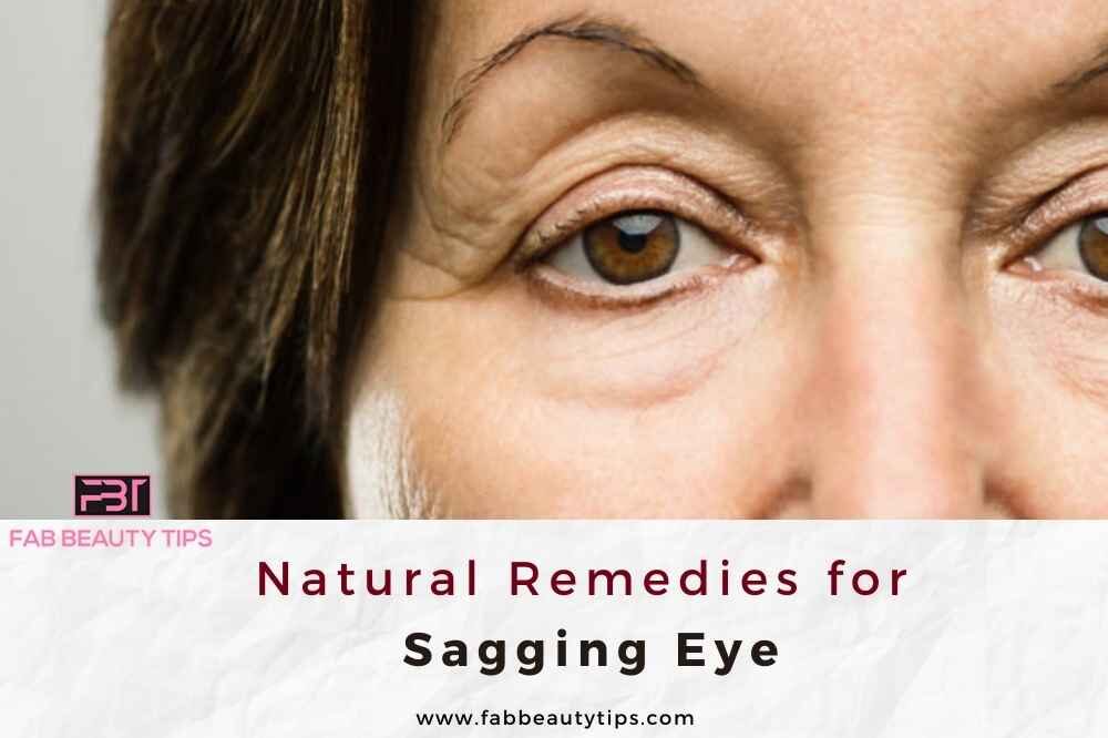 Sagging Eye, Natural remedies for sagging eye