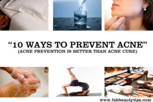 acne,acne prevention,skin
