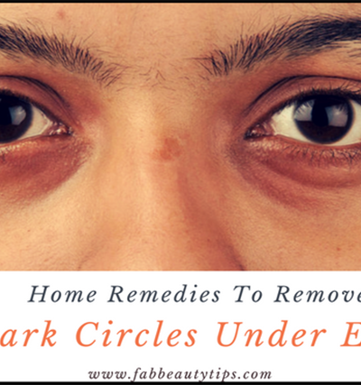best way to get rid of dark circles, dark circles, dark circles under eyes, home remedies to remove dark circles, remove dark circles under eyes