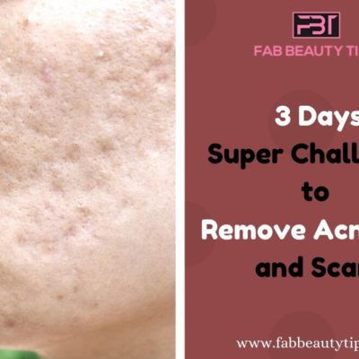 Remove Acne Scars in 3 Days with this Magical Home Remedy
