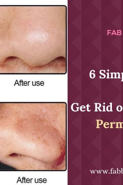 how to get rid of blackheads, get rid of blackheads on nose permanently, get rid of blackheads on nose with toothpaste, six steps to get rid of blackheads