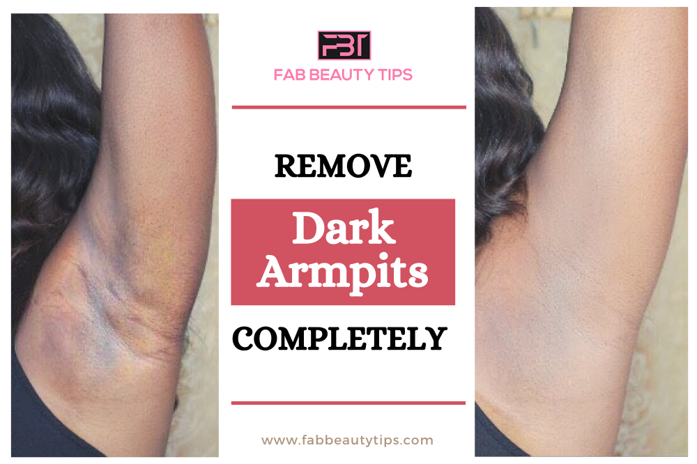 Get rid of dark armpits in a week,Home Remedies for Dark Armpits, Dark Armpits home remedies, get rid of dark armpits