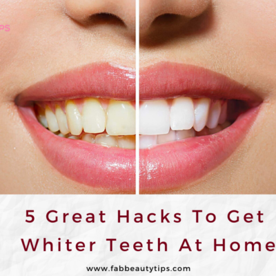5 Great Hacks to get whiter teeth at home