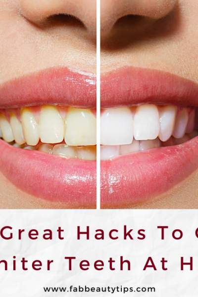 get whiter teeth, get whiter teeth at home, Hacks to get whiter teeth