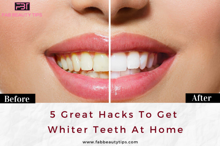 5 Great Hacks to get whiter teeth at home | Fab Beauty Tips