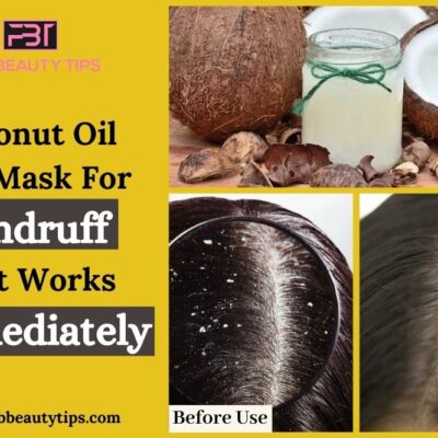 Coconut Oil Hair Masks for Dandruff that works immediately