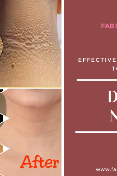 best remedy for dark neck, home remedies for dark neck, home remedies to get rid of dark neck, how to clean dirt on neck, how to get rid of dark neck home remedies, how to get rid of dark neck instantly, how to lighten black neck, how to lighten my dark neck