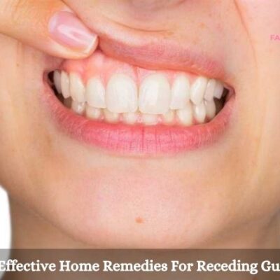 13 Effective Home Remedies For Receding Gums