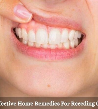 at home remedies for receding gums, best home remedies for receding gums, fixing gum recession, gum recession, natural remedies for receding gums