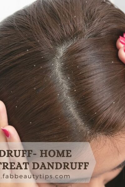 different kinds of dandruff, different types of dandruff on scalp, flaky scalp dry hair, flaky scalp oily hair, types of dandruff and treatment