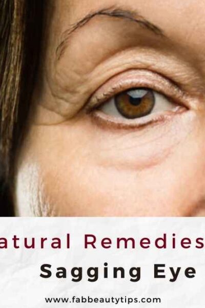 Sagging Eye, Natural remedies for sagging eye